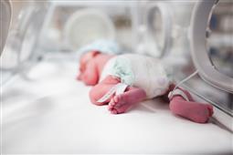 Factors that cause premature birth in New York,NY
